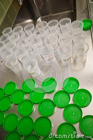 many preparation pots were opened to fill them with formalin Stock Photo