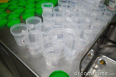 many preparation pots were opened to fill them with formalin Stock Photo