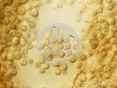 Many spores of a slime mold. Microscopy Stock Photo
