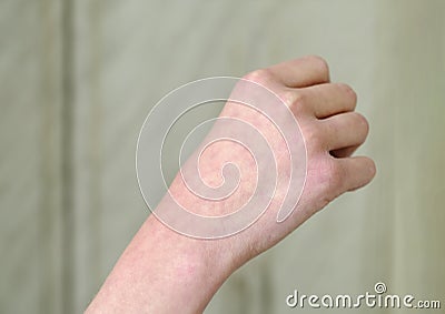 The vascular pattern is located on a person`s arm or on his hand. Blood of person Stock Photo