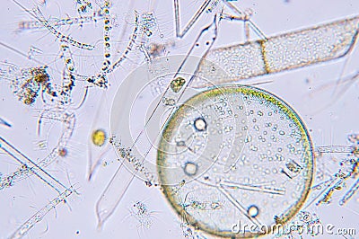 Marine aquatic plankton under microscope view Stock Photo