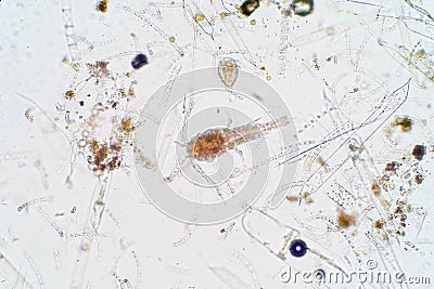 Marine aquatic plankton under microscope view Stock Photo