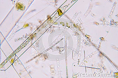 Marine aquatic plankton under microscope view Stock Photo