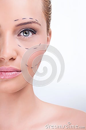 Marking for cosmetic plastic surgery Stock Photo