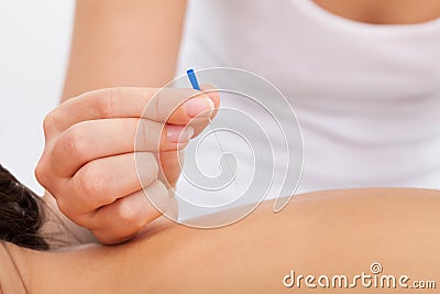 Masseuse holding needle Stock Photo