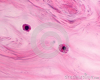 The mast cell or mastocyte it is a connective tissue cell characterized by its cytoplasm filled with large granules rich in Stock Photo