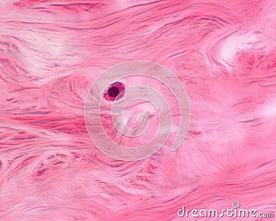 Connective tissue. Mast cell Stock Photo