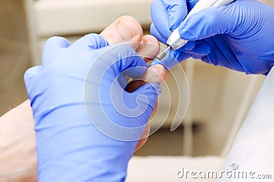 Master chiropody shapes the nails . Male patient in the process of hardware pedicure procedure. Concept body care. Close up, selec Stock Photo