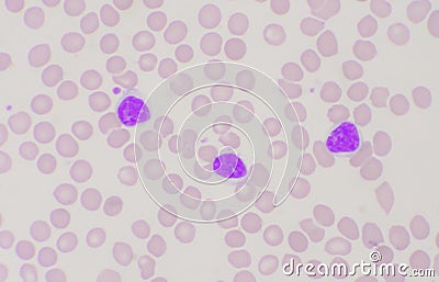 Mature lymphocyte on red blood cells background Stock Photo
