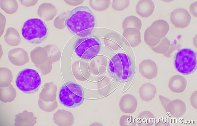 Mature lymphocyte on red blood cells background Stock Photo