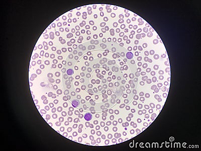 Mature lymphocytes on red blood cells background Stock Photo