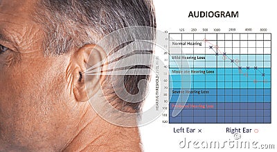 Mature man with symptom of hearing loss Stock Photo