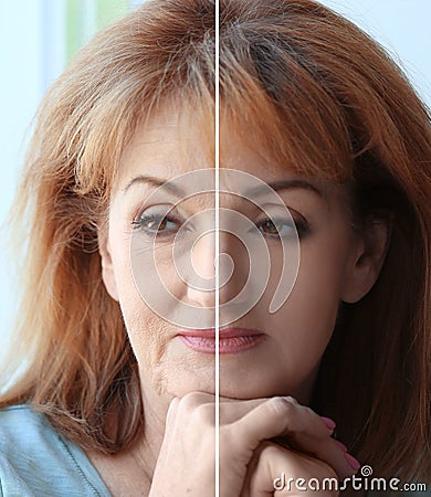 Mature woman before and after cosmetic operation on blurred background Stock Photo