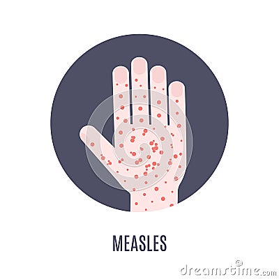 Measles rash on a hand medical icon Vector Illustration