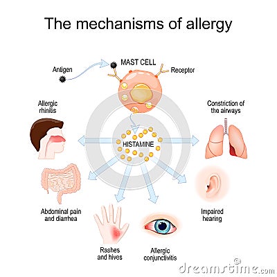 Mechanism of allergy. Mast cells and allergic reaction. Histamine Vector Illustration