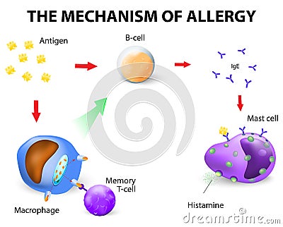 Mechanism of allergy Vector Illustration