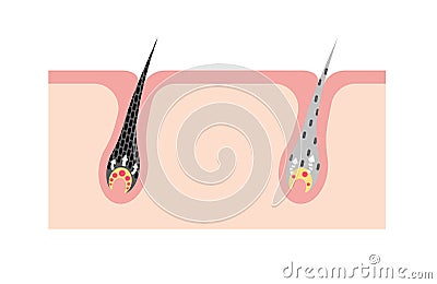 Mechanism of pigmented hair and gray hair / comparison vector illustration / no text Vector Illustration