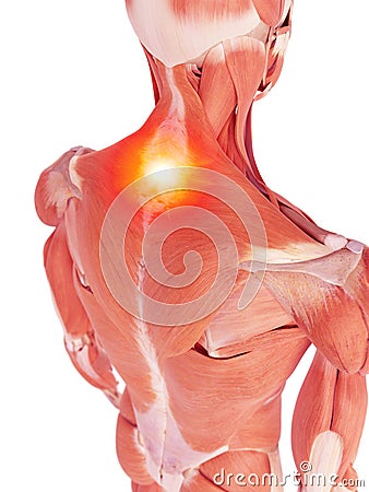 The back muscles showing pain Cartoon Illustration