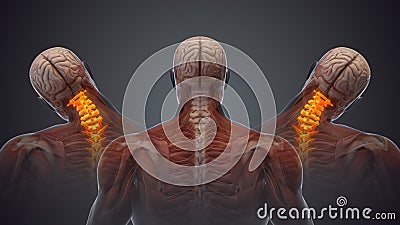 Medical animation for neck pain Stock Photo