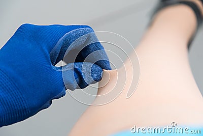 Medical compression stockings for varicose veins. Dressing compression knitwear in special gloves. The ribbed surface Stock Photo