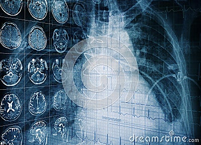 Medical concept of a patient`s examination using modern technolo Stock Photo