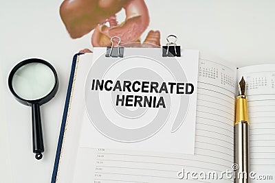 On the table there is a magnifying glass and a notepad with the inscription - Incarcerated hernia Stock Photo