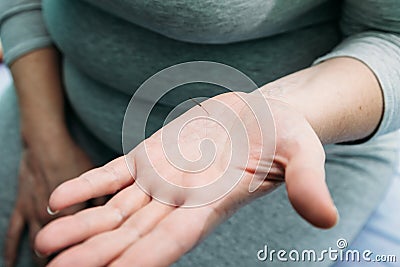 Medical doctor performs acupuncture on patients arm Stock Photo