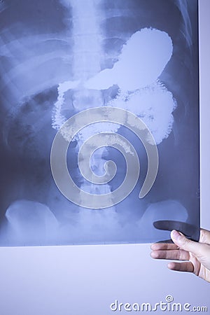 Medical xray spine hip scan Stock Photo