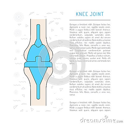 Medical illustration knee joint Vector Illustration