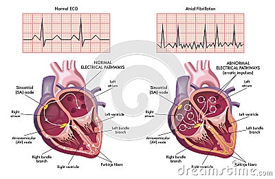Medical heart diagrams Vector Illustration