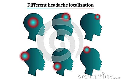 Medical infographic template set - types and localizations of headache, migraine. Human head silhouette with pain Vector Illustration