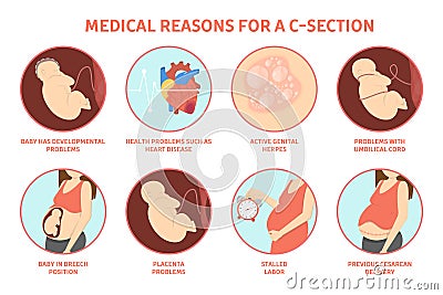 Medical reasons for cesarean delivery or c-section. Vector Illustration