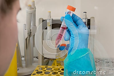 Medical samples prepared in the laboratory for cancer screening Stock Photo