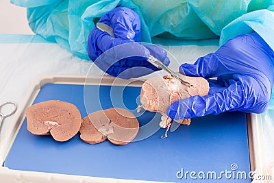 Medical student in anatomy dissecting a kidney Stock Photo