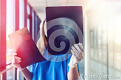 Medical worker looks at xray film of the skull to detect signs of the disease Stock Photo