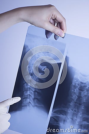 Medical xray spine neck scan Stock Photo