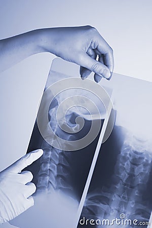 Medical xray spine neck scan Stock Photo