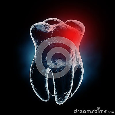 Medically Accurate Aching Tooth X-Ray View with Red Zone of Pain. 3d Rendering Stock Photo