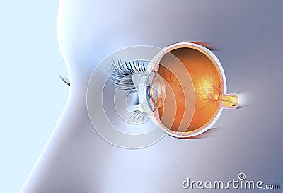 Human eye with artificial lens, medically 3D illustration Cartoon Illustration