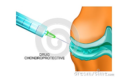 Medication of the joints Vector Illustration