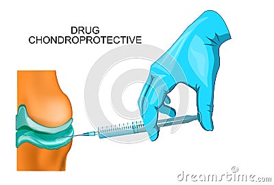 Medication of the joints Vector Illustration