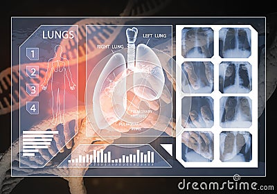 Medicine user interface Stock Photo