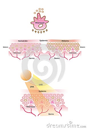 Melanocyte, melanin, melanogenesis vector Vector Illustration