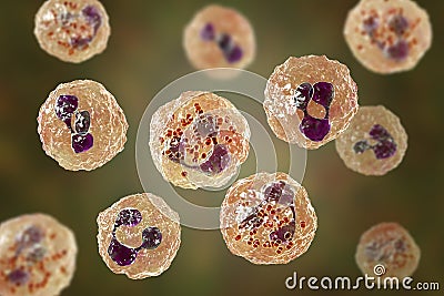 Meningococcal meningitis, cerebrospinal fluid smear Stock Photo