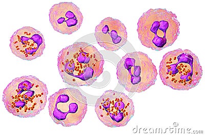 Meningococcal meningitis, cerebrospinal fluid smear Cartoon Illustration