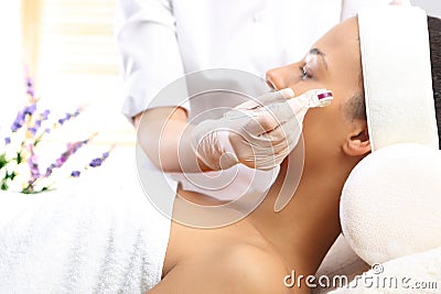 Mesotherapy microneedle, the woman at the beautician Stock Photo