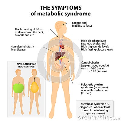 Metabolic syndrome Vector Illustration