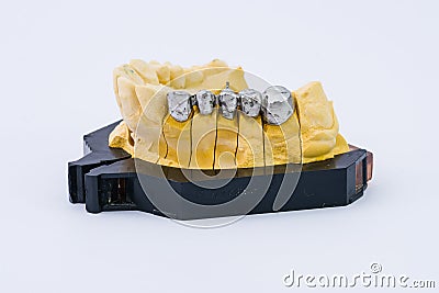 Metal teeth for prosthesis Stock Photo