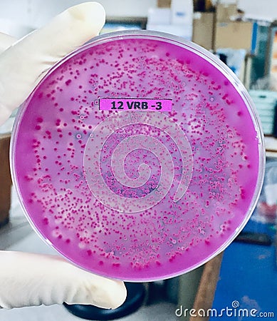 Microbiology E.coli bacteria on Culture medium Stock Photo