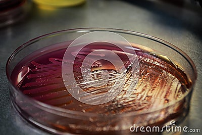 Microbiology Escherichia coli colonie in Macconkey agar Stock Photo